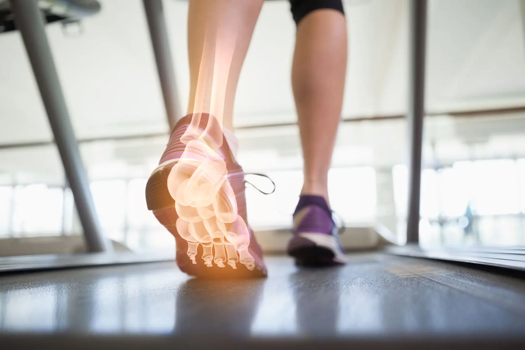 44790049 - digital composite of highlighted foot bones of jogging woman